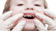 Rotten teeth (Image via Getty Images)